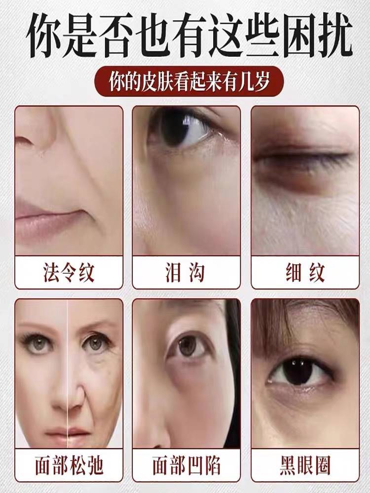 眼袋要怎样消除？小妙招大公开！