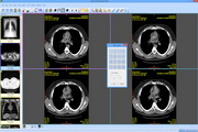 Sante DICOM Viewer FREE4.0.14