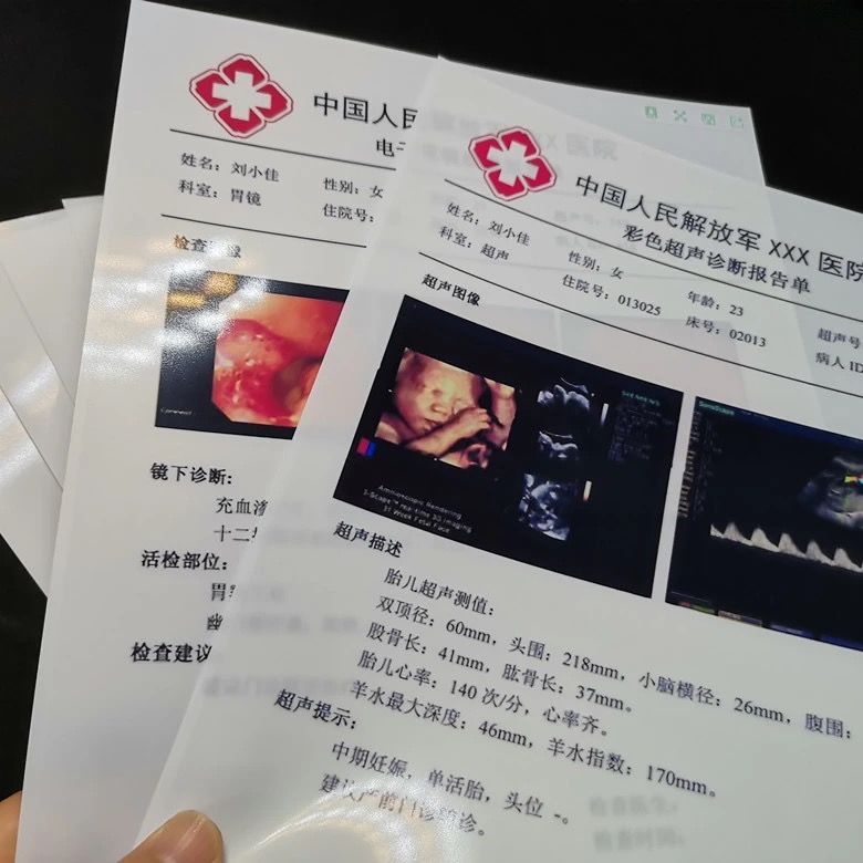 医用胶片打印纸：高清影像，守护健康每一刻！