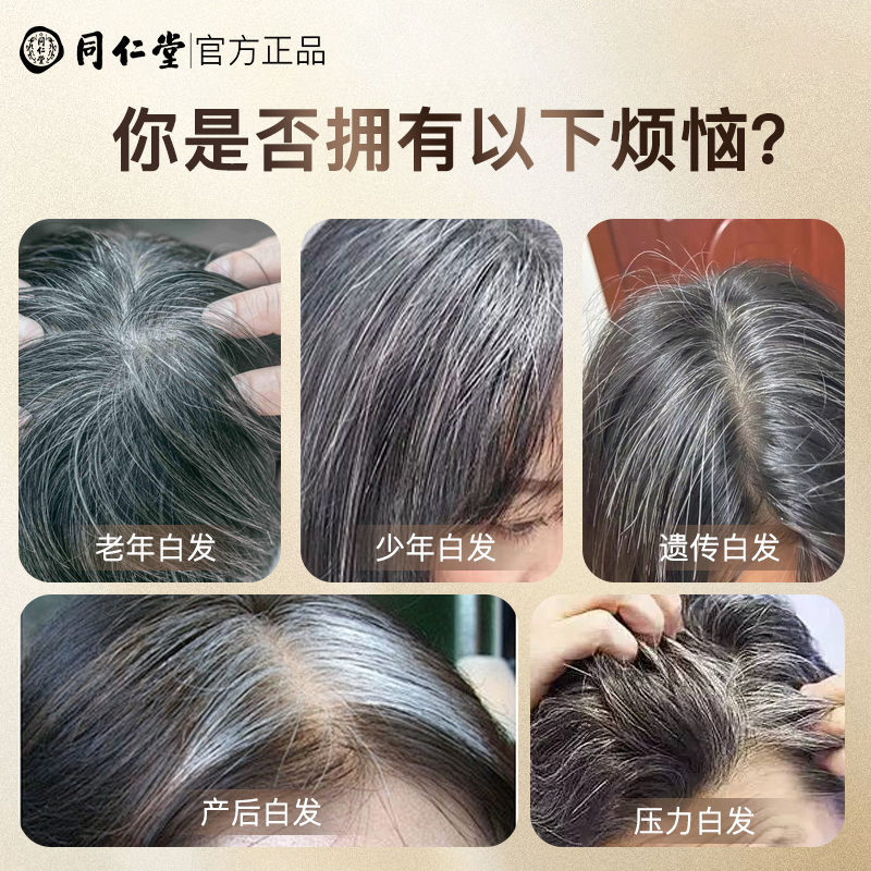 染发剂哪个牌子最好最安全最健康？