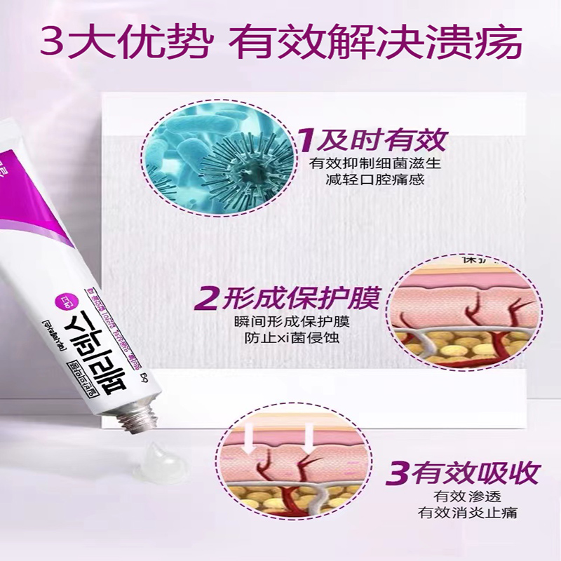 【自营】韩国Peridex绿十字口腔溃疡上火凝胶，终结口舌疮痛苦的神器？