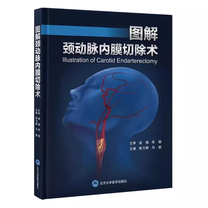 【出版社直销】图解颈动脉内膜切除术：手术解剖与技巧的权威指南