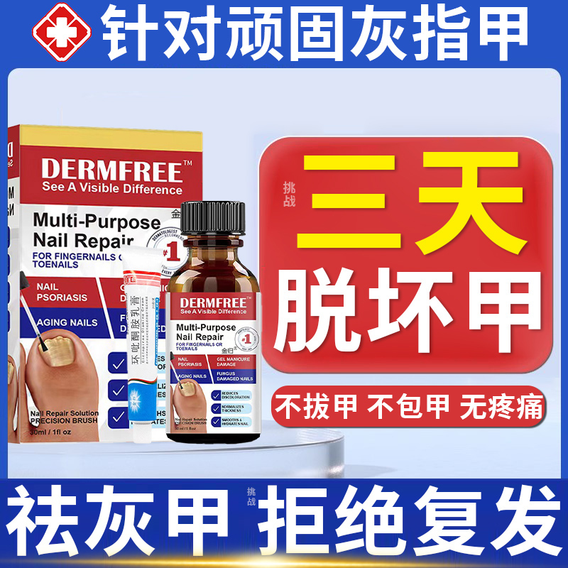 灰指甲救星来了！日本一滴净抗真菌液真的能治吗？亲测效果太惊艳了