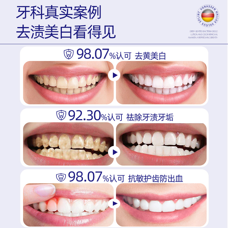 揭秘牙膏的秘密成分：二氧化硅增稠剂，美白牙齿新利器
