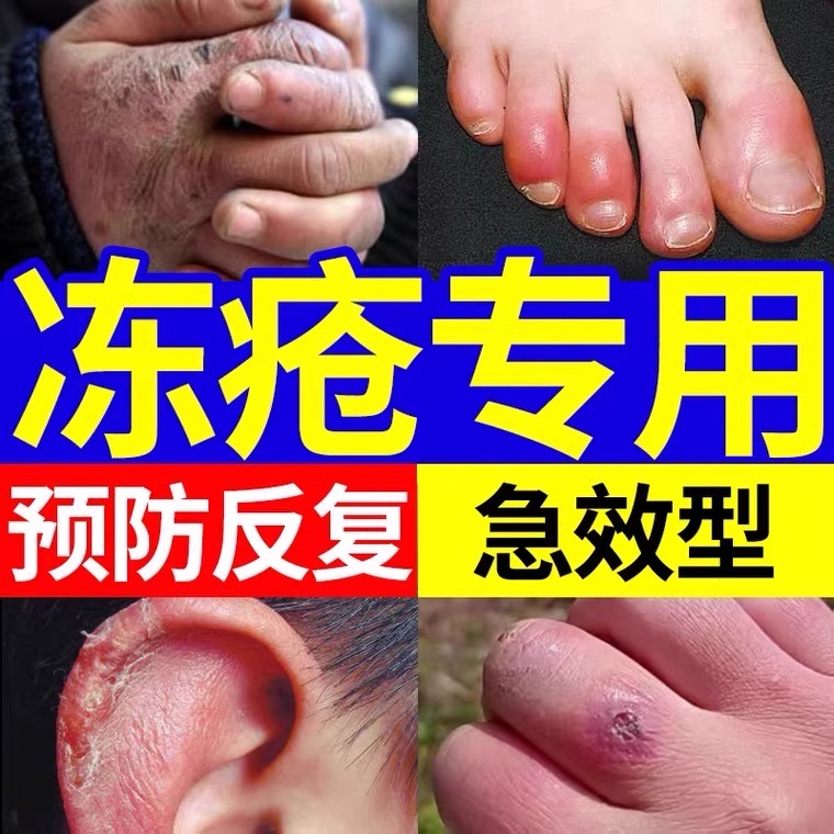 为什么用了纽西之谜后脸会烂了？