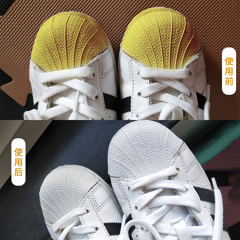 鞋子鞋边去黄神器大揭秘！小白鞋变新如初，告别发黄烦恼