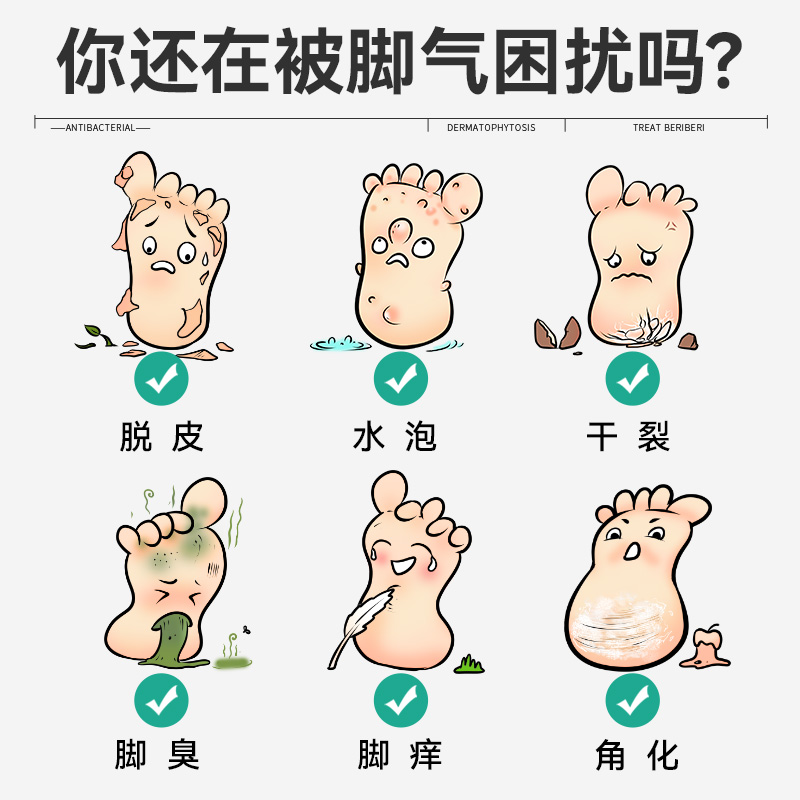 洛芙洛夫联苯洛芙联苯苄唑喷雾 vs 止痒膏：谁才是脚气克星？