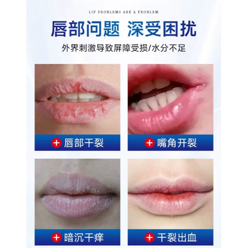 为什么唇膏涂在嘴上会辣辣的疼？可能原因大揭秘