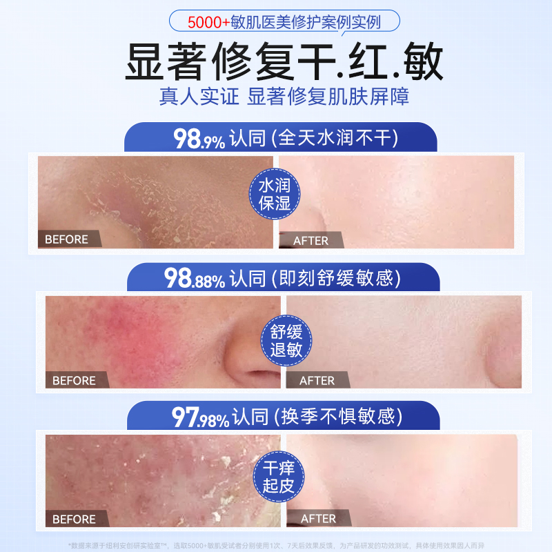 冬季脸干燥起皮怎么办？补水小妙招有哪些？