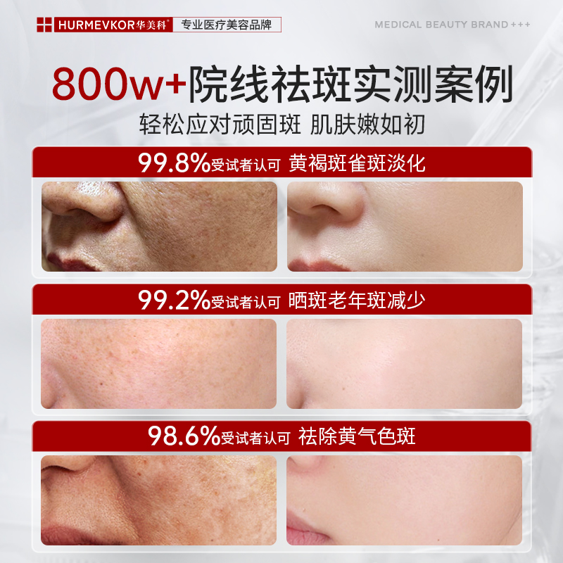 黄褐斑最快的祛斑方法是什么？如何科学祛斑？