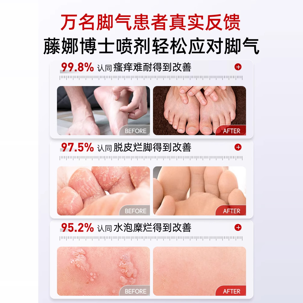 藤娜脚气喷雾：告别脚气困扰，重获清新脚丫！✨