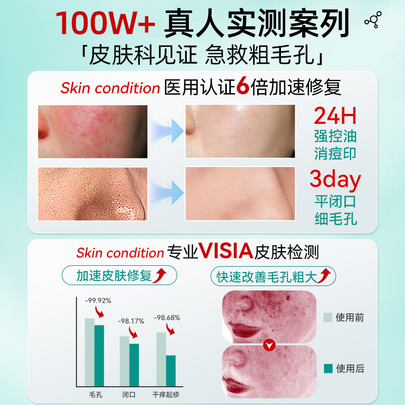 为什么女生毛孔会粗大？这些问题你一定要知道！