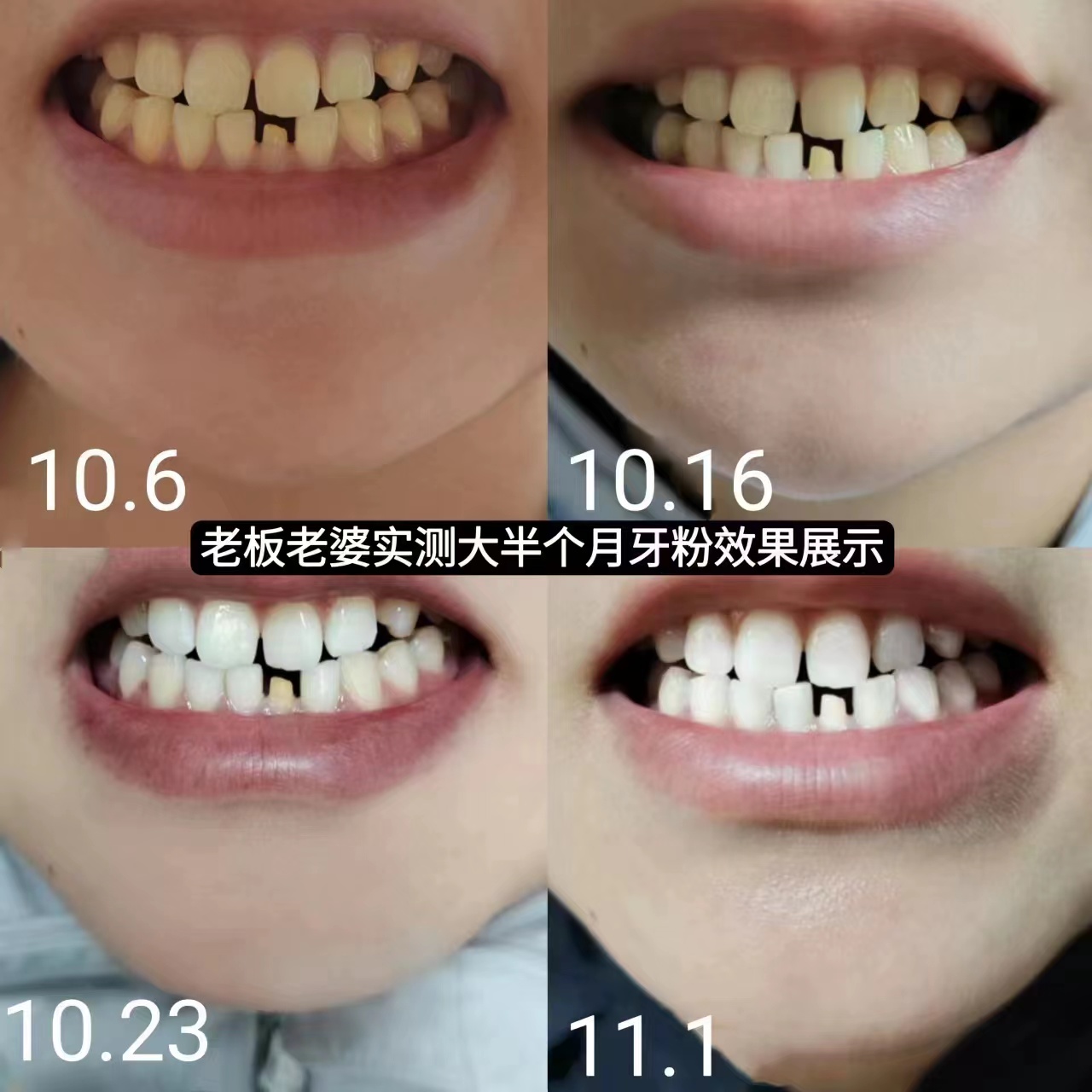 9D牙贴：牙齿美白新神器，告别黄牙污垢，速效清洁的秘密武器！