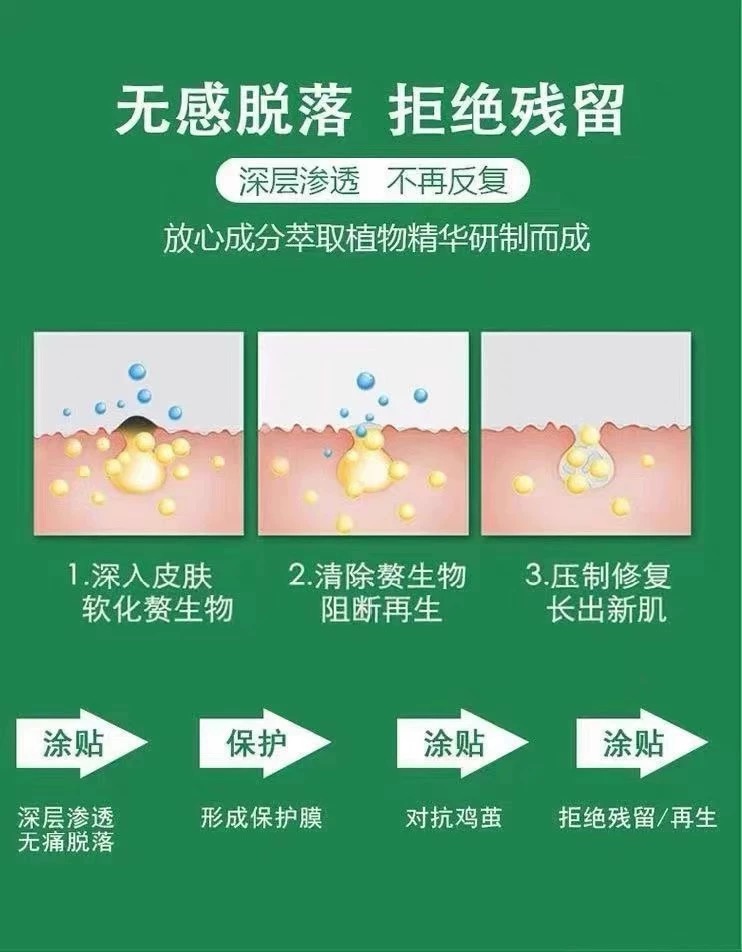 告别脚底烦恼，【云南草本】鸡眼专用膏，轻松祛除肉刺猴子！