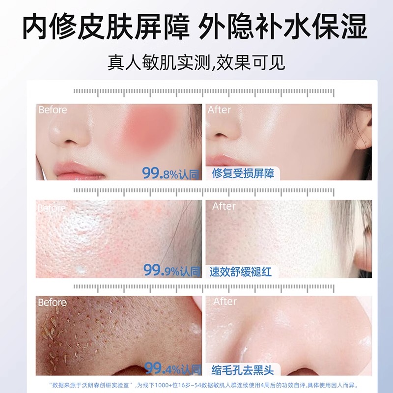 为什么用了纽西之谜后脸发痒还冒痘？