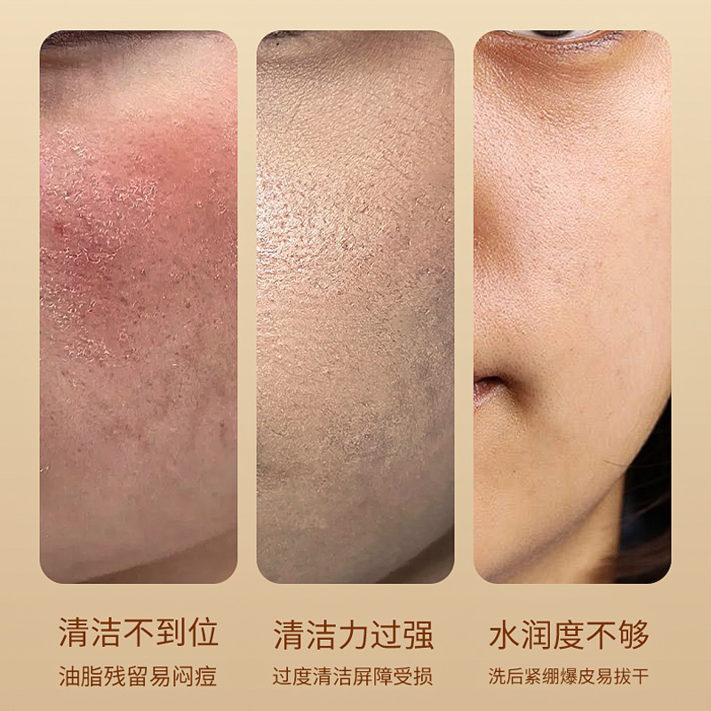金妮雅硫磺洁面乳：告别痘痘肌，开启清爽护肤新纪元✨