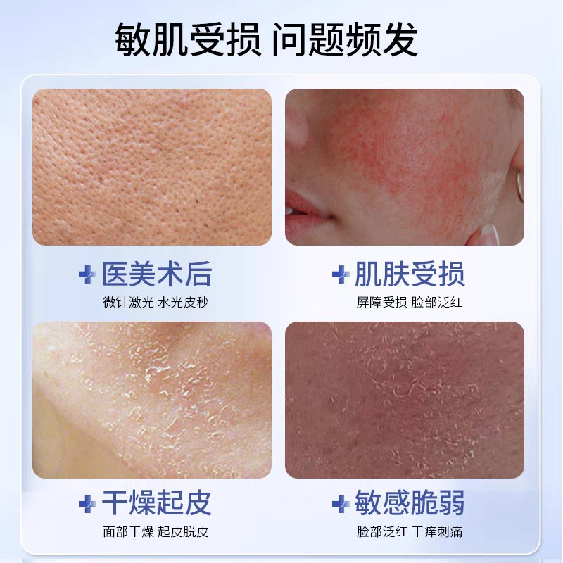 术后修复神器！蓝铜胜肽冻干粉真的绝了！敏感肌救星+激光点斑痣必备！