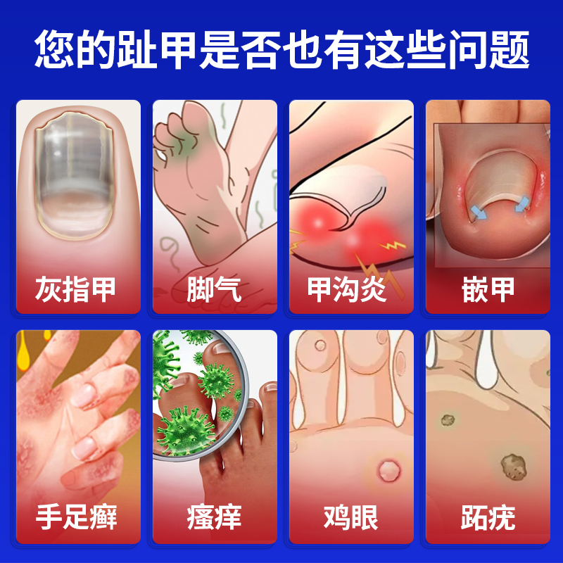 百医星足部敷料&amp;抑菌液：终结脚气、灰指甲，让你重获健康美足！✨