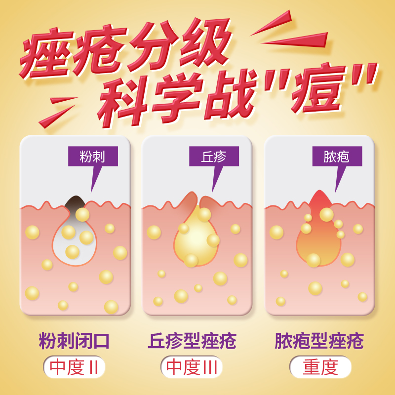 【3盒装】云昆金花消痤丸：告别痘痘、牙痛、便秘，全面调理肺胃热盛的神器！