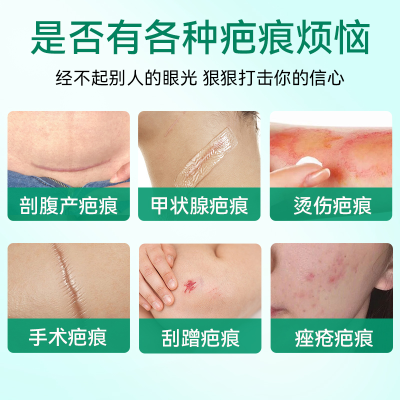祛疤用什么效果最好？专业护肤博主为你解答