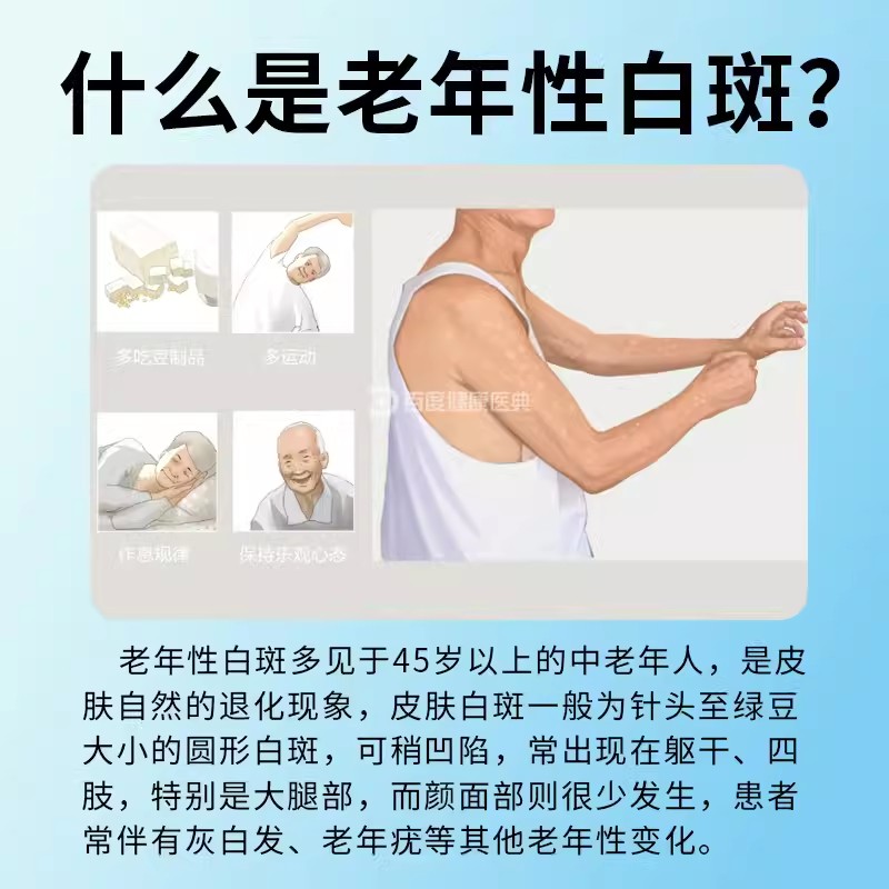 30多岁长老年斑怎么办？