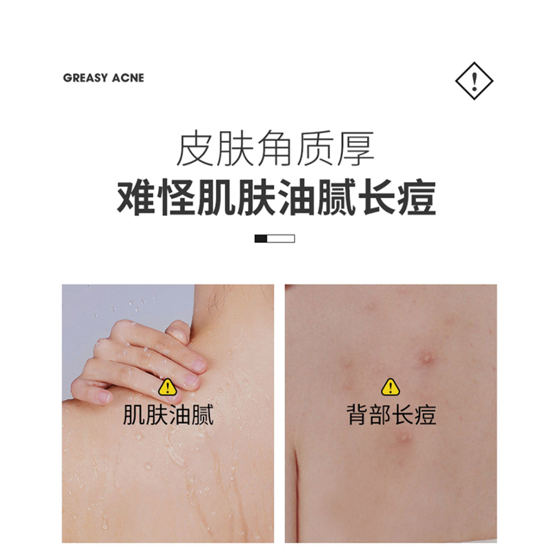 搓泥宝男士专用：告别死皮，重塑肌肤的终极神器！