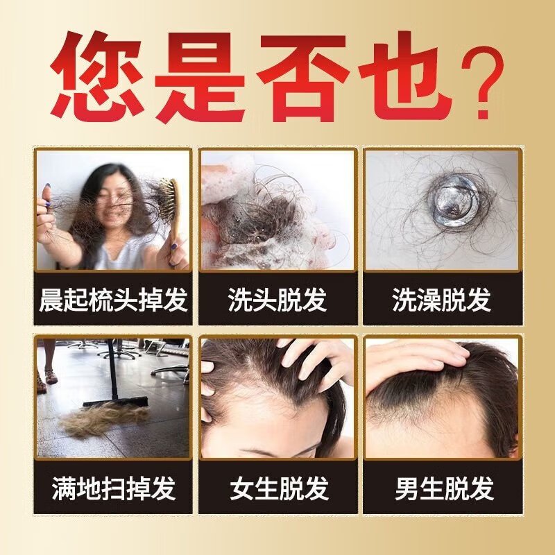 怎么判断是脱发还是掉发？教你轻松分辨！