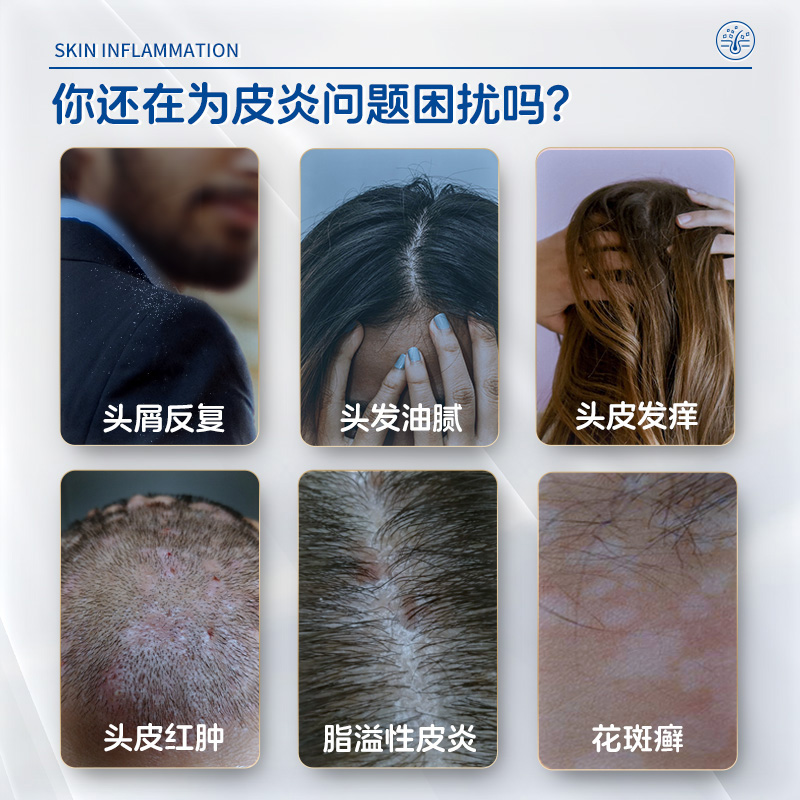 【回购率99%】二硫化硒洗发水，敏感头皮的救星？男女通用，各大商超热销的秘密武器！