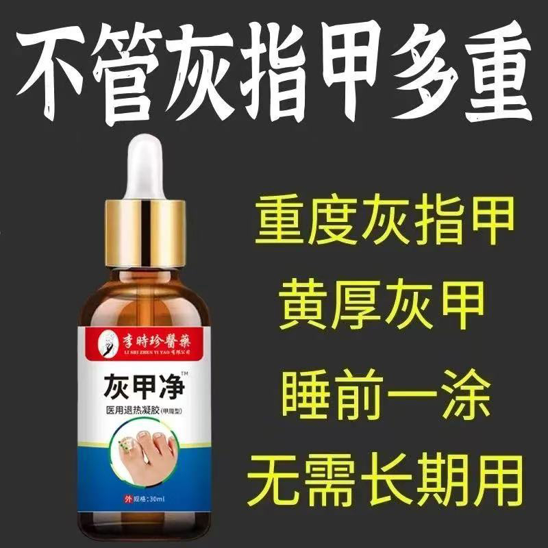 每天滴一滴，99%灰钾抑菌液：无痛去除手脚趾坏钾的秘密武器！