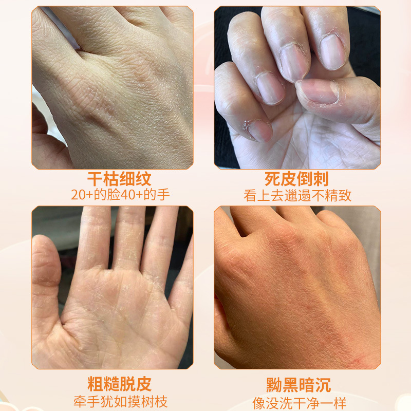 好物推荐 | 奶奶手变少女手，告别煮妇手，买2送1同款，还你细嫩双手！