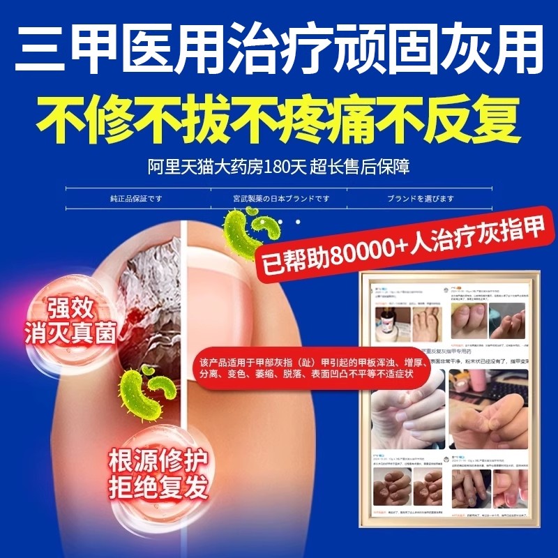 告别灰指甲，一滴净亮甲——日本特效药，专治真菌感染，正品保障！