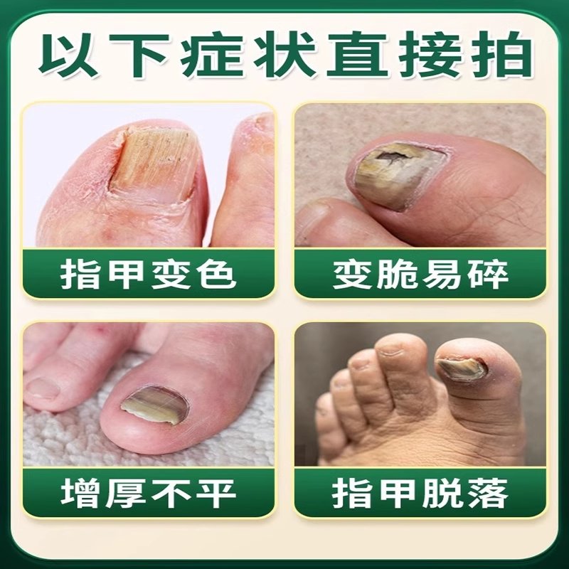 滴一滴坏甲变好钾，【不净包退】甲甲净，享受好甲生活的神奇秘诀！