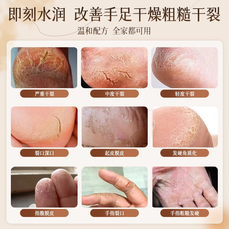Fentury马油膏：冬季手足护理神器，告别干裂，迎接滋润新生活！✨