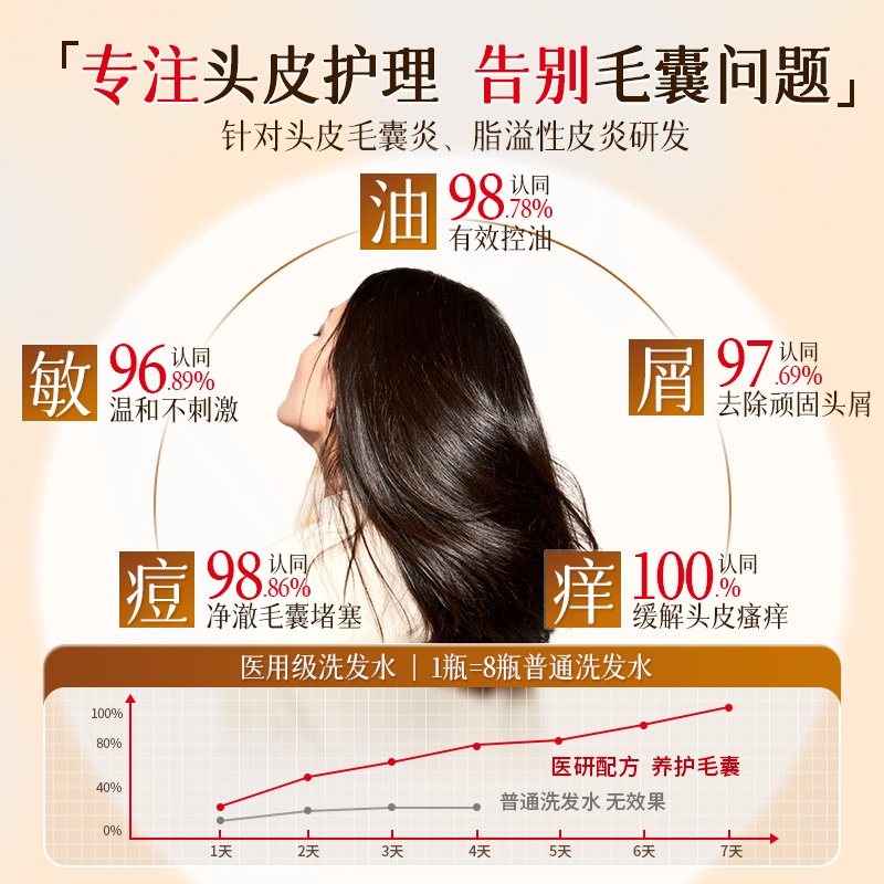脂溢性脱发最简单的自愈方法有哪些？