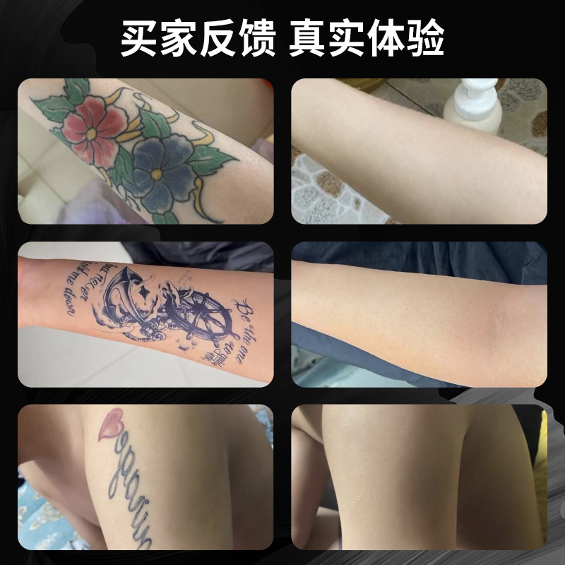 宜哲尔PAX纹身遮盖神器：告别胎记白斑，重塑自信新颜！