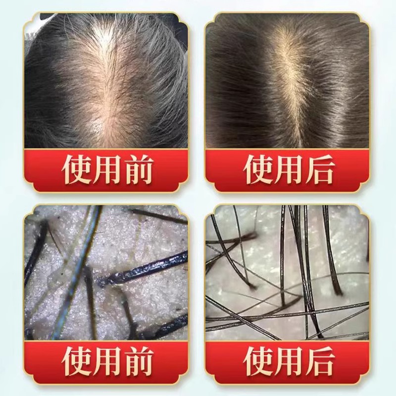 【拍1发5】京神.医草本熬制洗发水：二十味草本植物萃取，头发问题全解决！✨