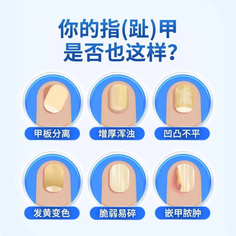 家用制氧机坏了，一般去哪里维修呢？