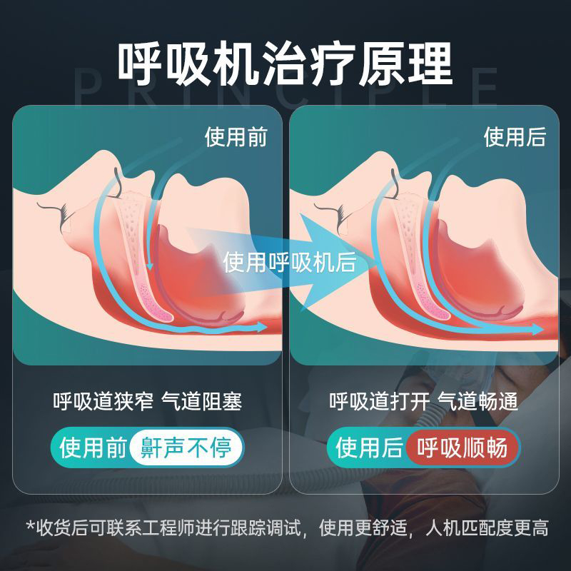 添泰药店家庭医用ST双水平无创慢阻肺呼吸机，老人肺气肿排二氧化碳神器！️