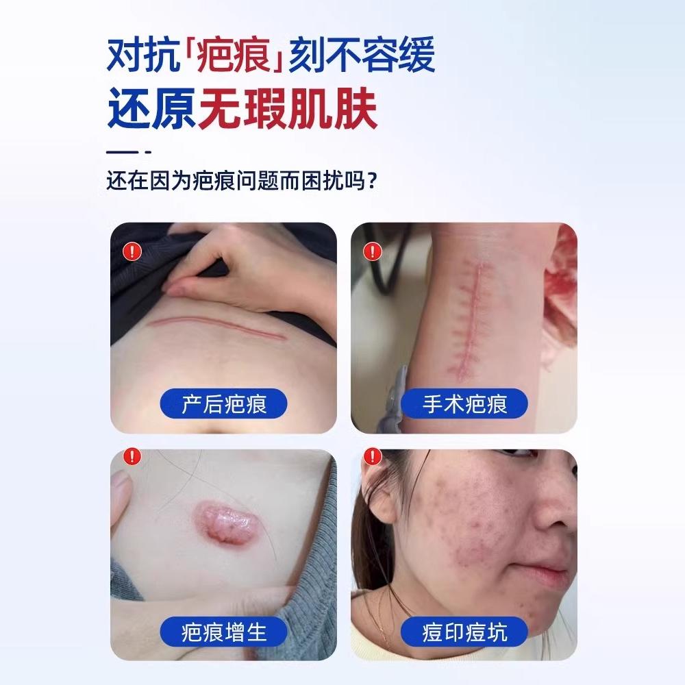 提眉术后多久疤痕会变得不明显？恢复期需要注意什么？