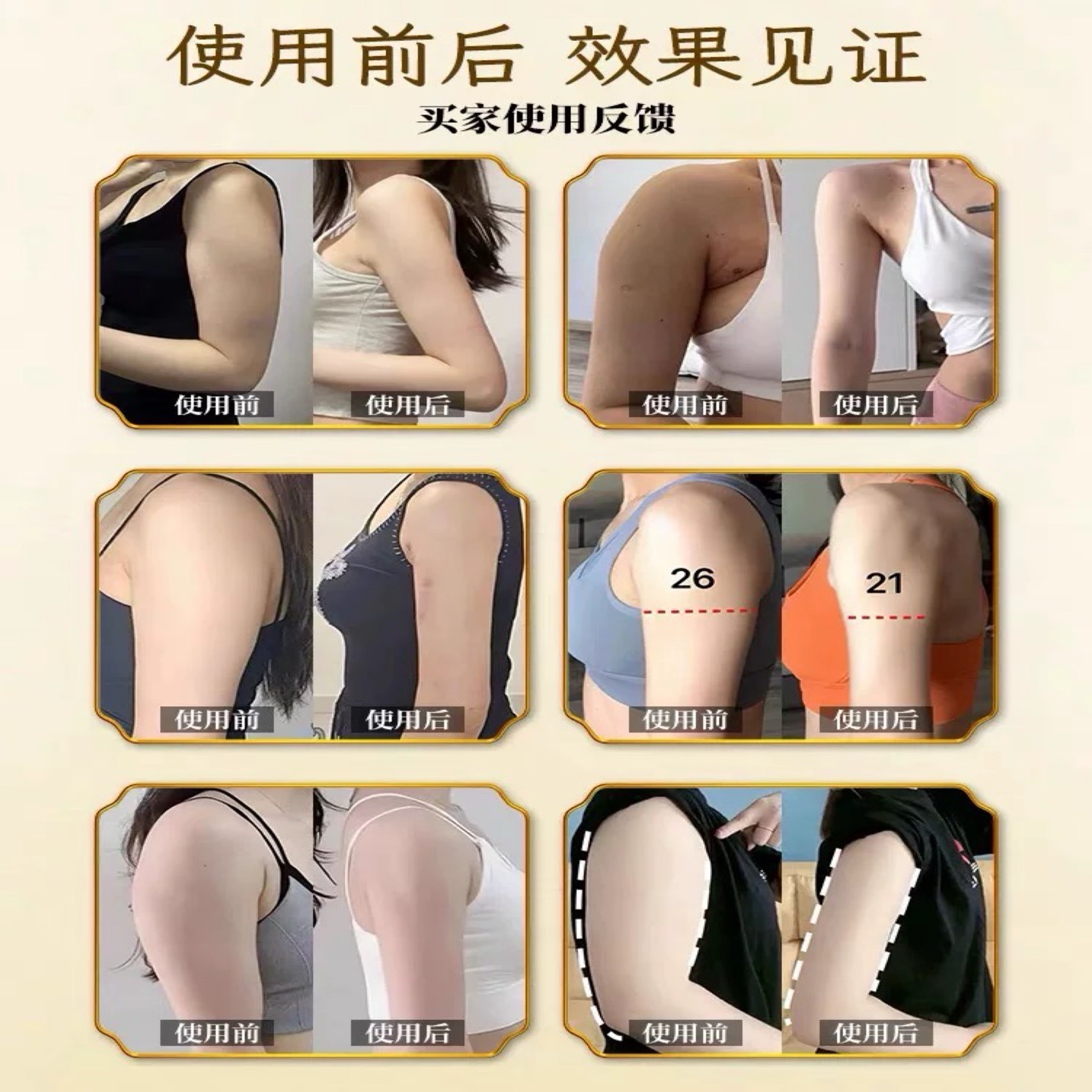 告别麒麟臂，女神燃脂贴助你轻松拥有细蝴蝶臂！✨