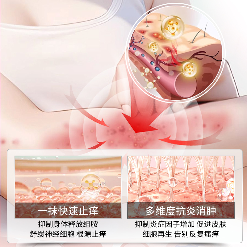 神经性皮炎湿疹膏怎么选？止痒去根真有用吗？避坑指南来了！
