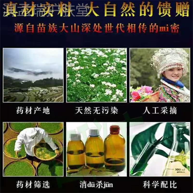 脚气星人救星！广玉花脚藓净真的能根治？亲测效果太惊艳了！