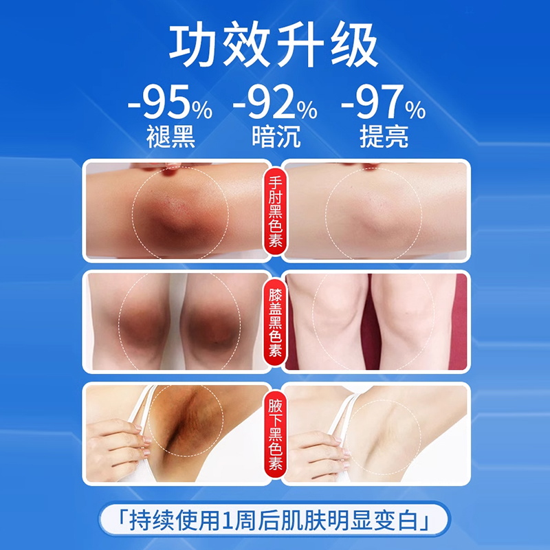 夏天变白神器大揭秘：胳膊肘、腋下、膝盖关节美白攻略！