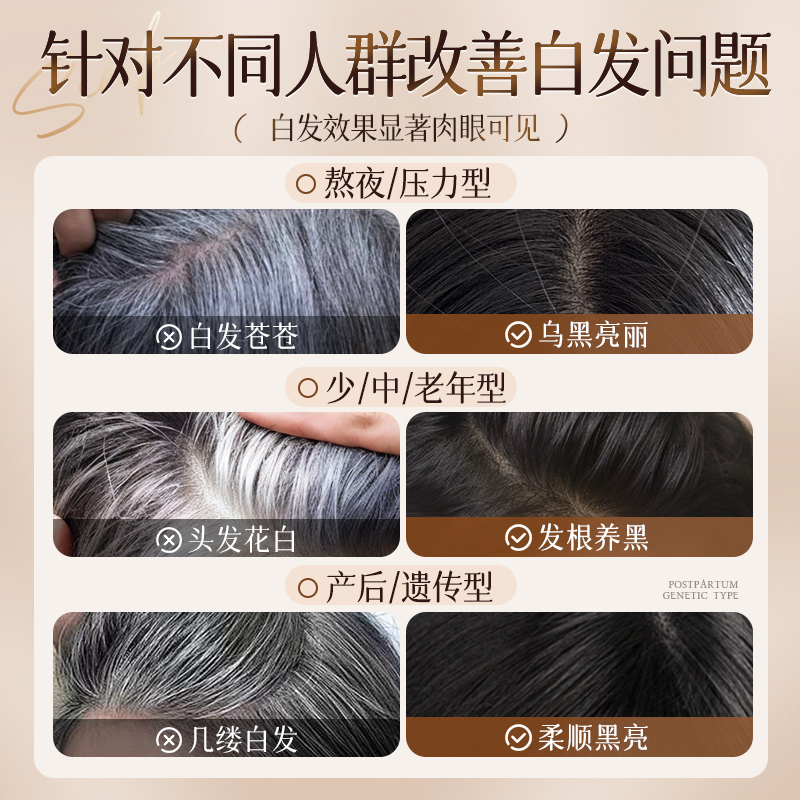 森发e森乌发乳三瓶装：告别白发，重拾乌黑秀发的秘密武器✨