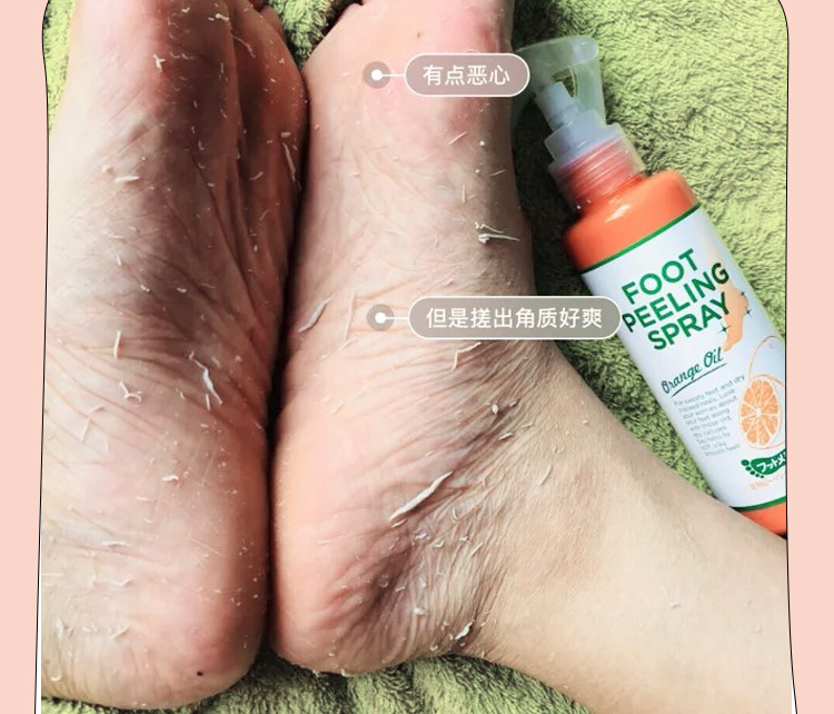 footmedi去角质喷雾：告别死皮老茧，享受丝滑脚感！