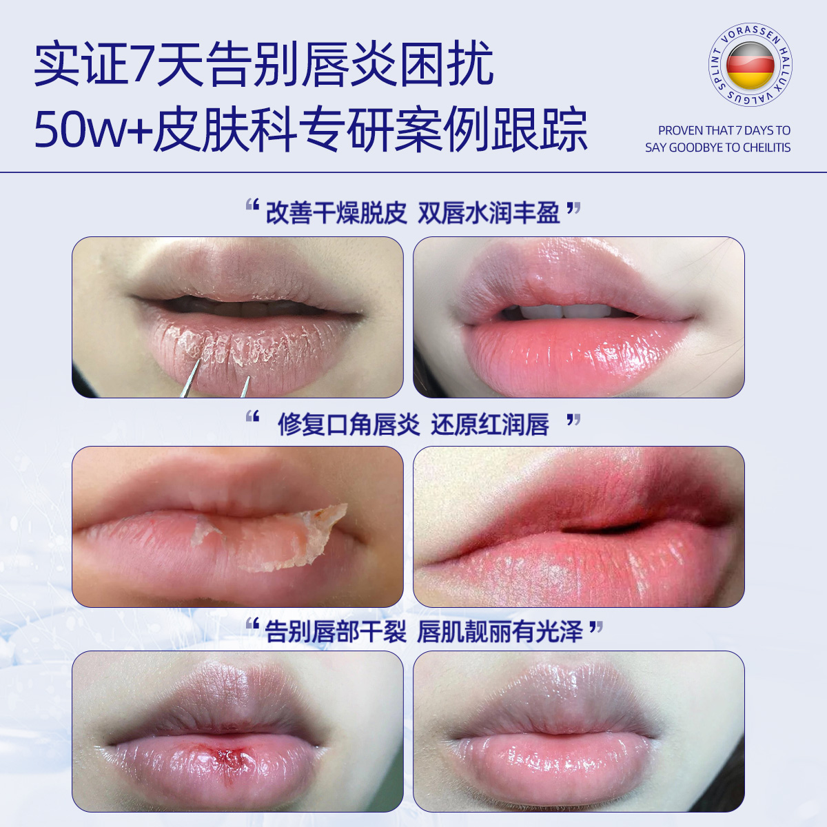 正规品牌唇膏排名前十，如何选择适合自己的唇膏？