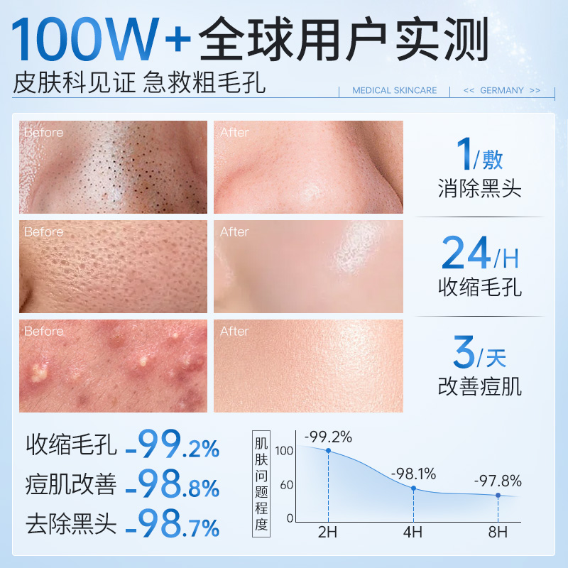 毛孔粗大做什么医美项目比较好？效果和安全性如何？