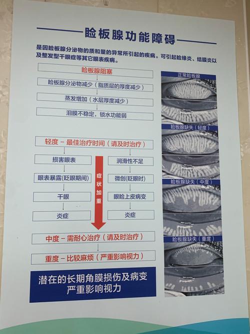 左眼计划,探索眼部健康与视力保护的重要性