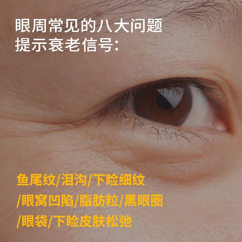 新疆伊帕尔汗美目紧致精油：告别黑眼圈，点亮双眸！
