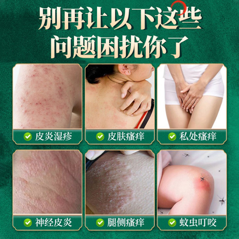 香港和记拔毒膏：快速止痒特效，告别干燥痒红痒的救星！